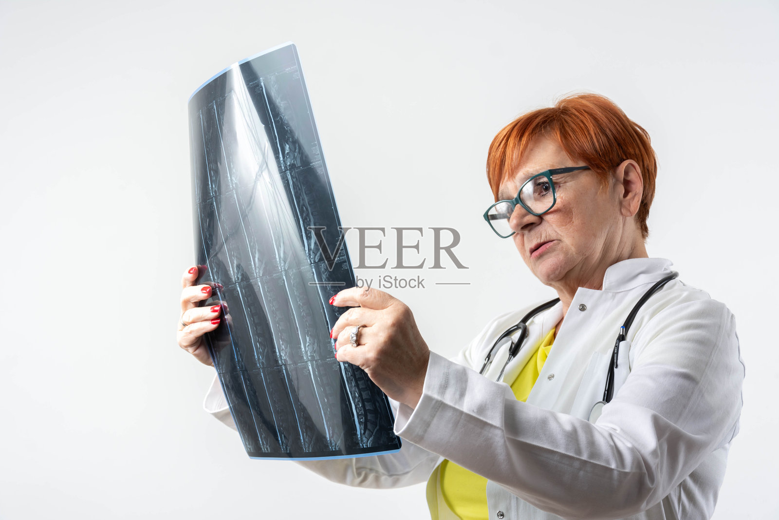 放射学临床诊断。照片摄影图片