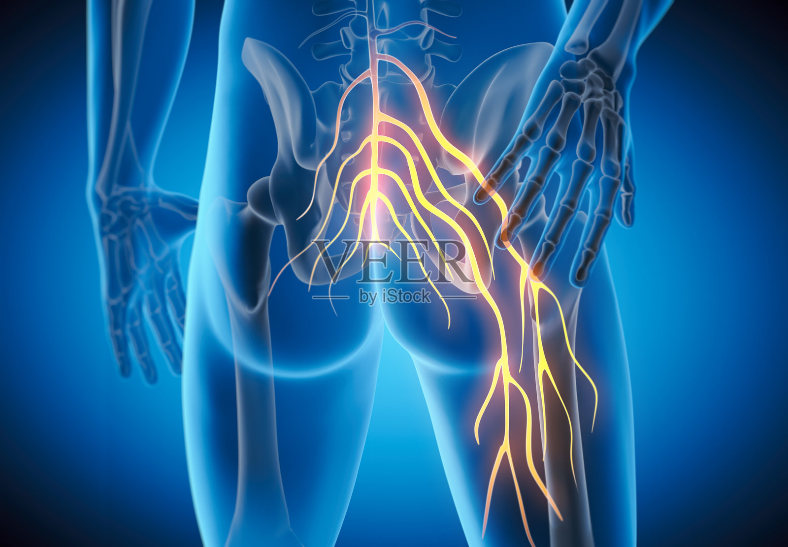 坐骨神经痛 - 坐骨神经受伤或刺激引起的神经疼痛照片摄影图片