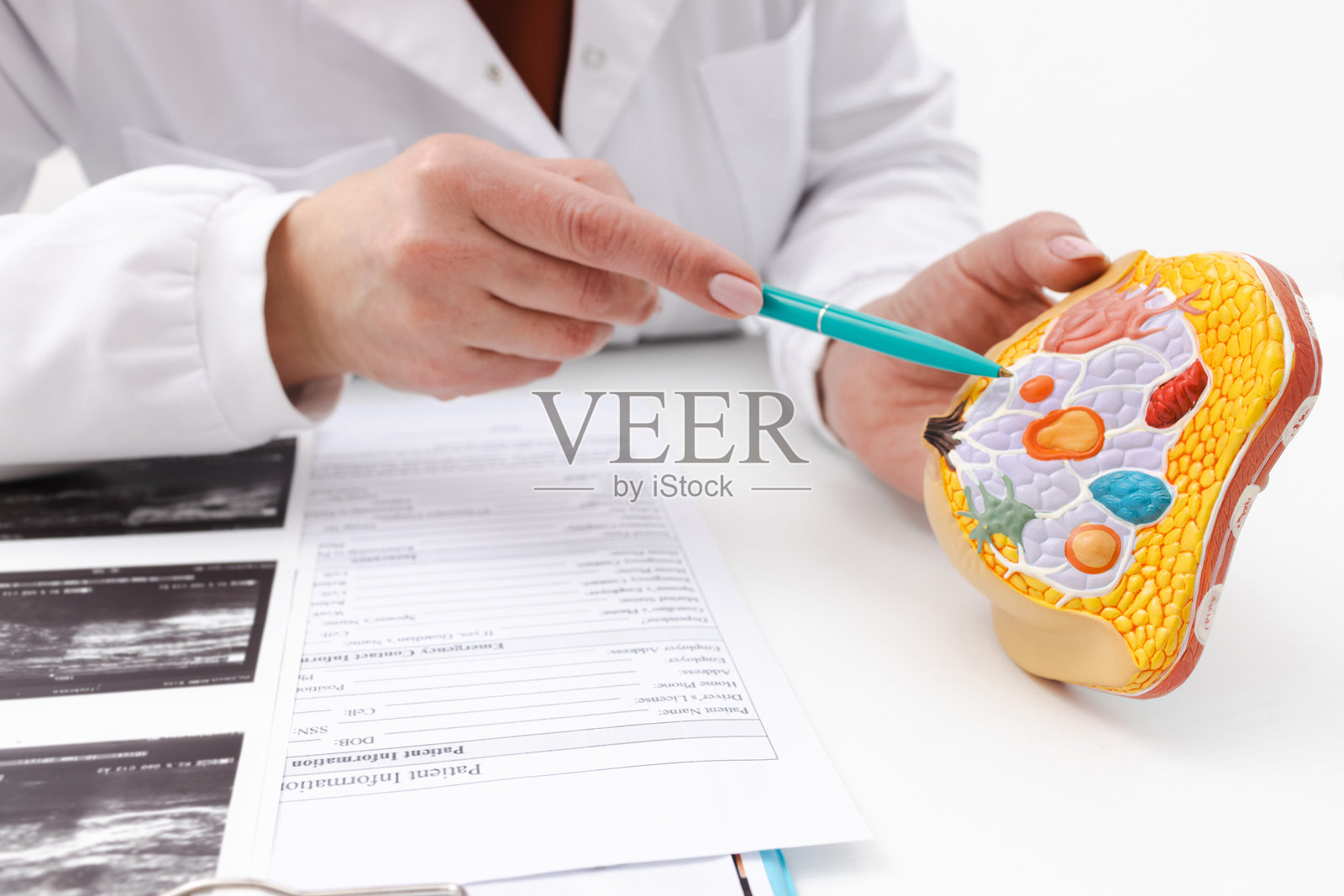 女性乳腺疾病患者的医生咨询。乳腺纤维腺瘤和癌症的治疗。照片摄影图片