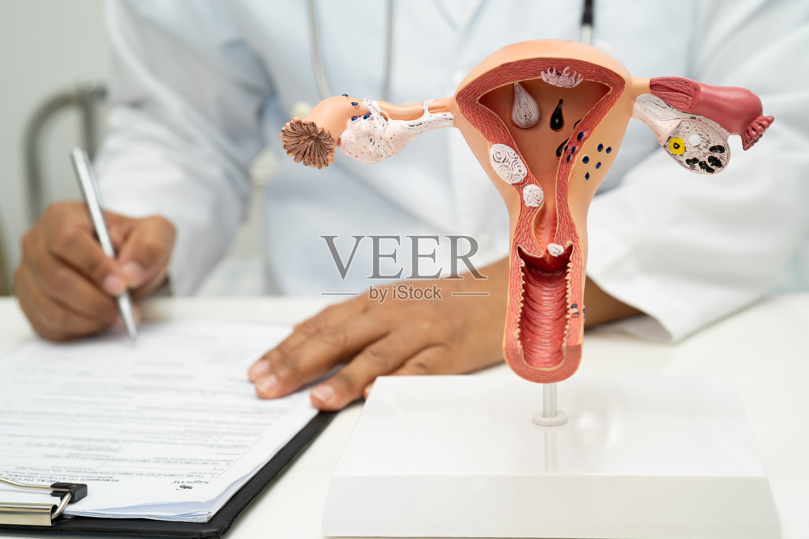 子宫，医生使用解剖模型进行研究、诊断和治疗。照片摄影图片