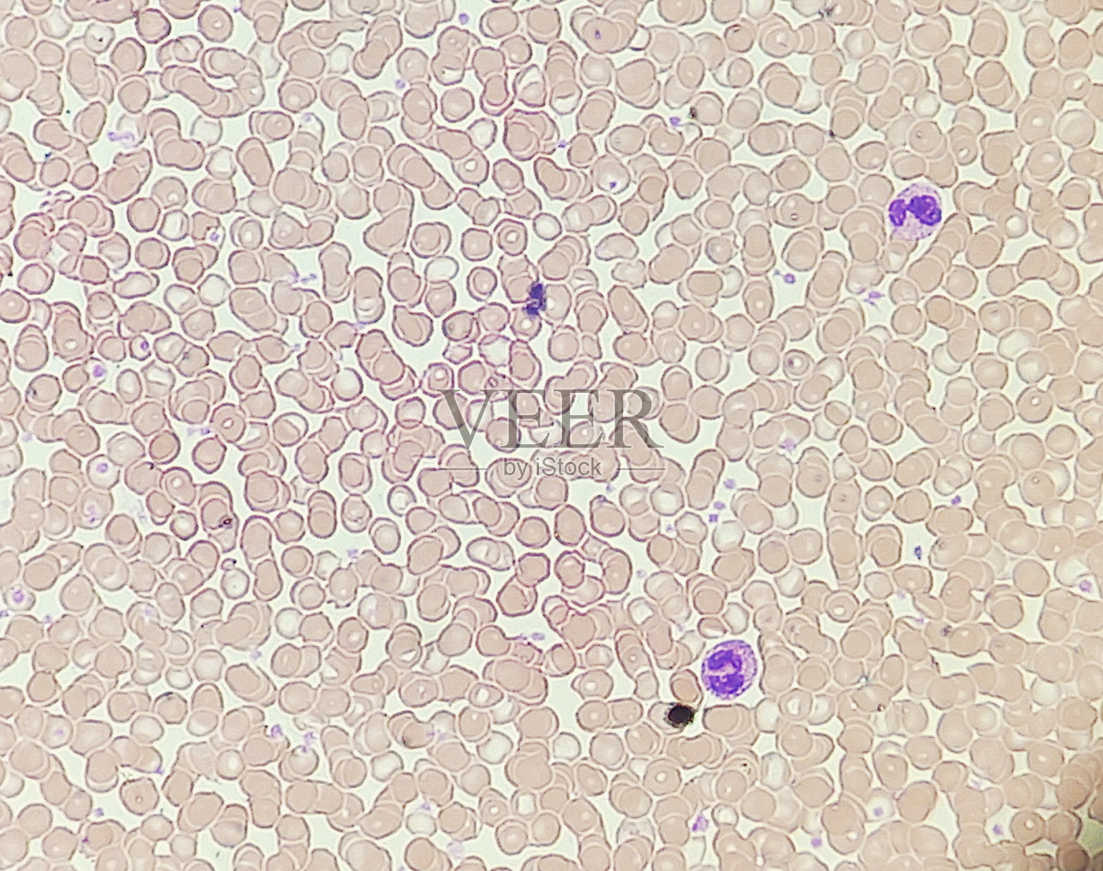 血液学（CBC）血液涂片显示来自40倍显微镜物镜的图像。照片摄影图片
