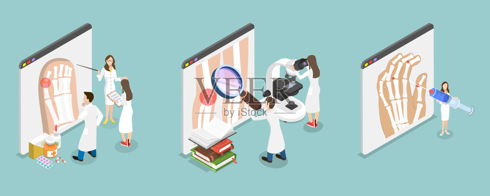 类风湿性关节炎的3D等距平面矢量插图插画图片素材