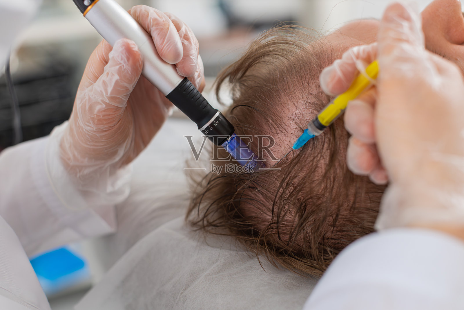 毛发专家为男性进行改善头发生长的治疗，包括微针美容和维生素注射。照片摄影图片