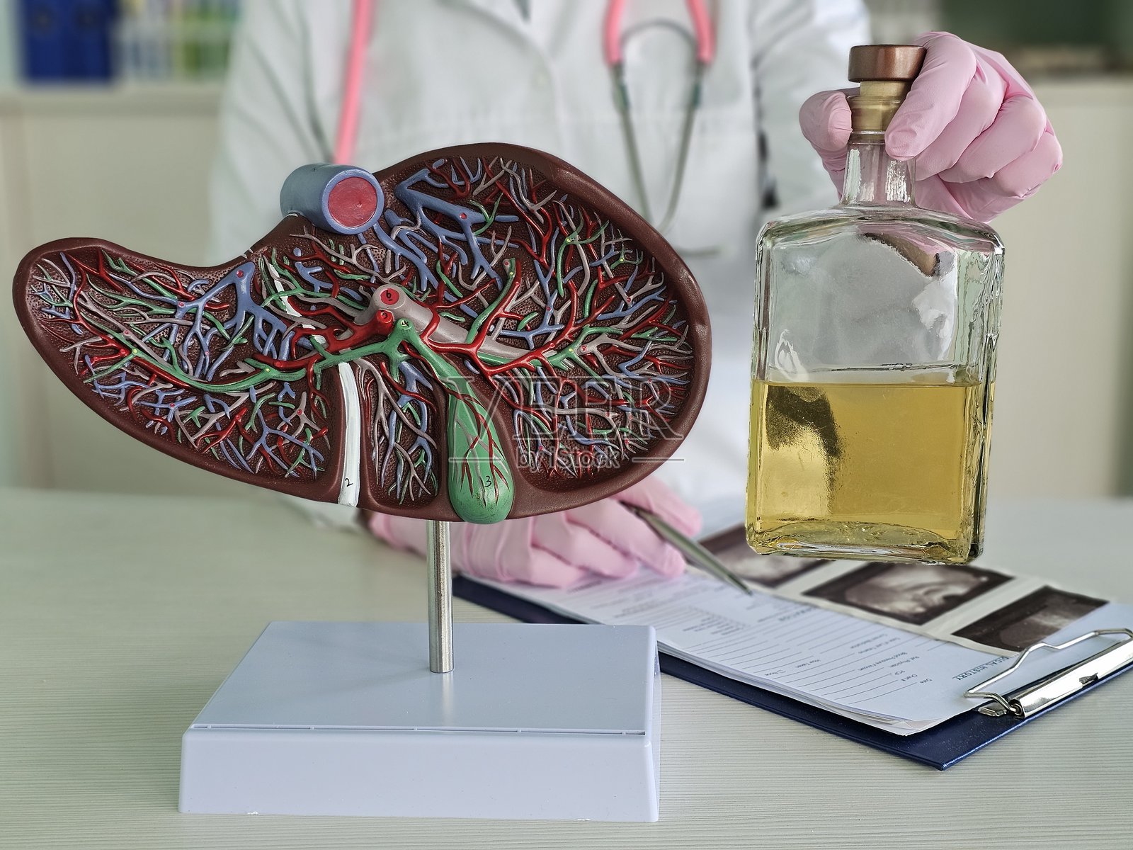 酒精性肝损伤和肝硬化的概念，涉及肝脏和酒精。肝硬化的原因包括酗酒、肝炎或非酒精性脂肪肝病。照片摄影图片