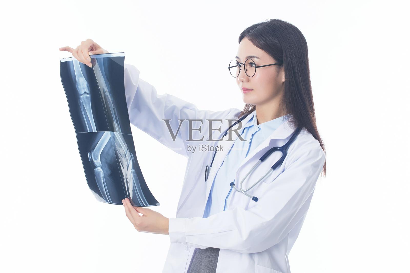 亚洲女性医生正在检查膝盖的X光片照片摄影图片