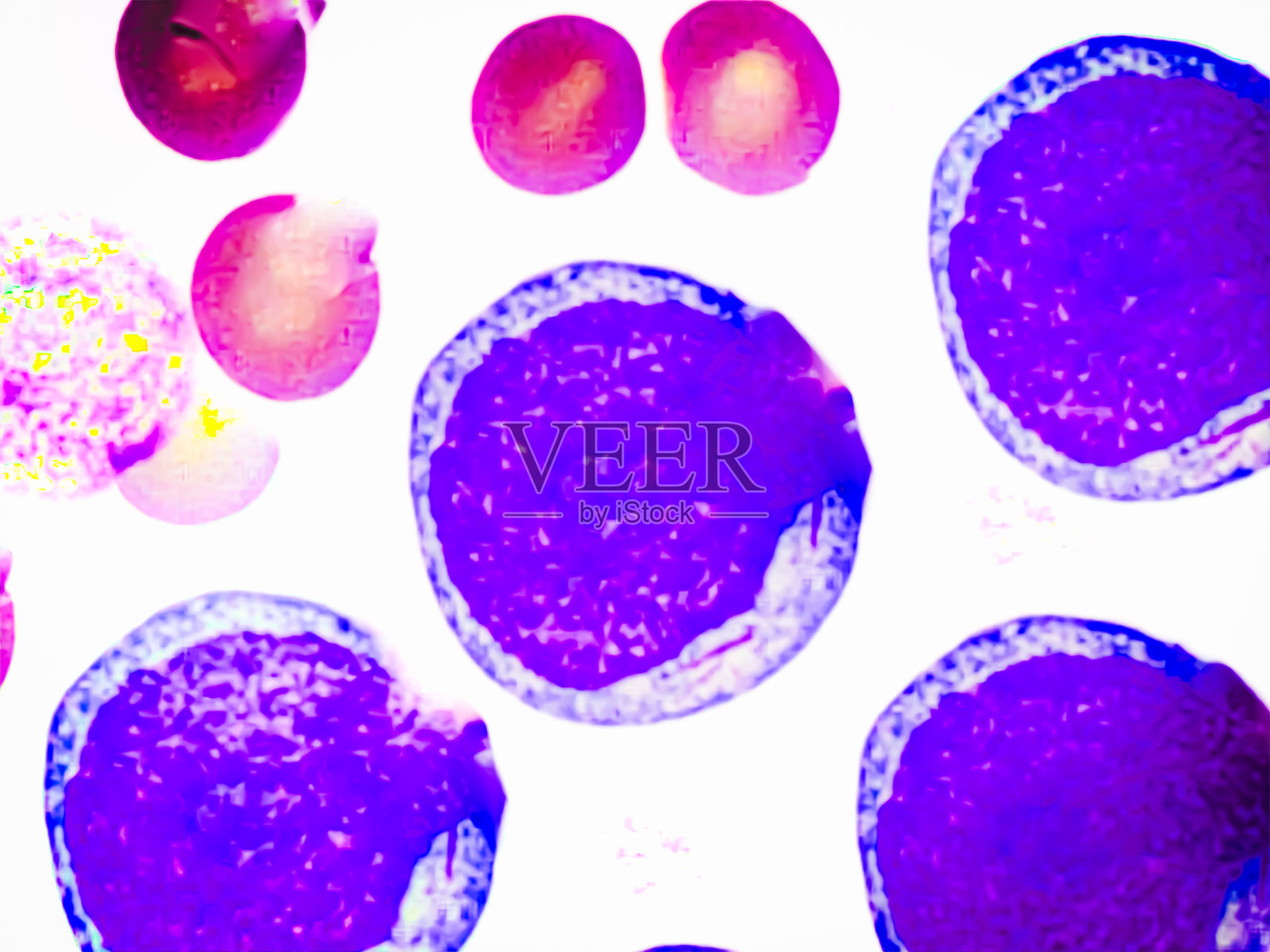 血涂片中通过显微镜分析的嗜碱性幼红细胞。照片摄影图片