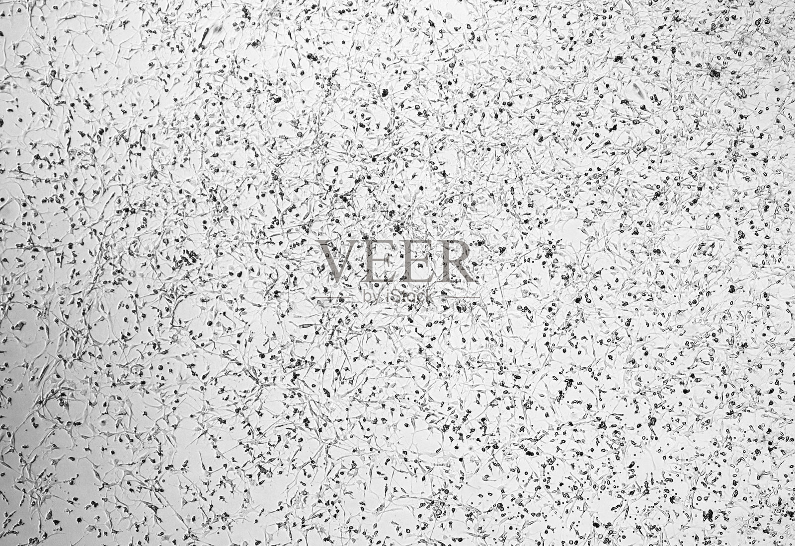 胶质母细胞瘤细胞培养。照片摄影图片