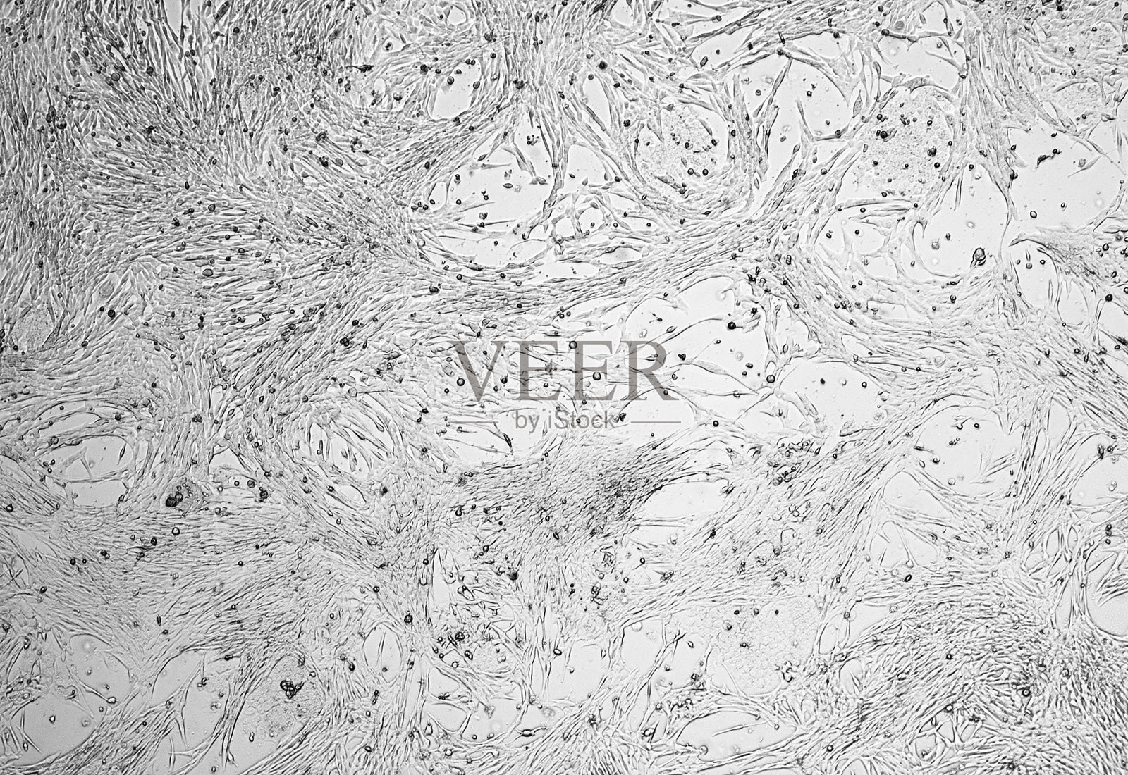 胶质母细胞瘤细胞培养。照片摄影图片