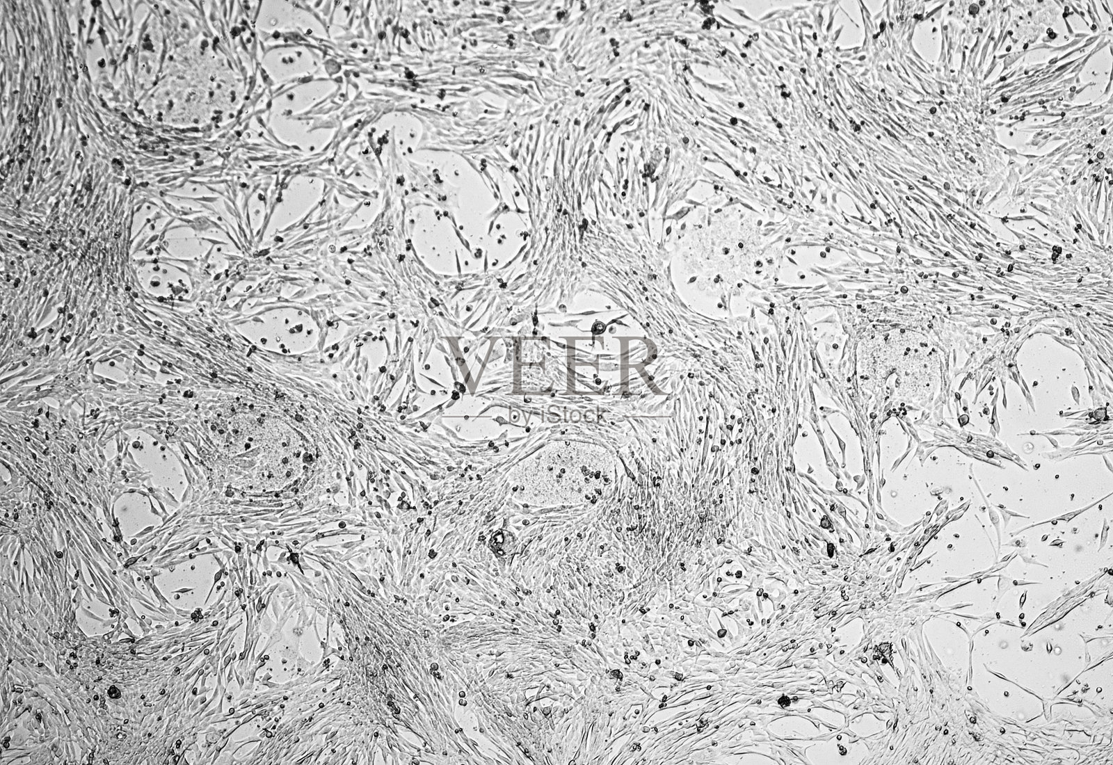 胶质母细胞瘤细胞培养。照片摄影图片