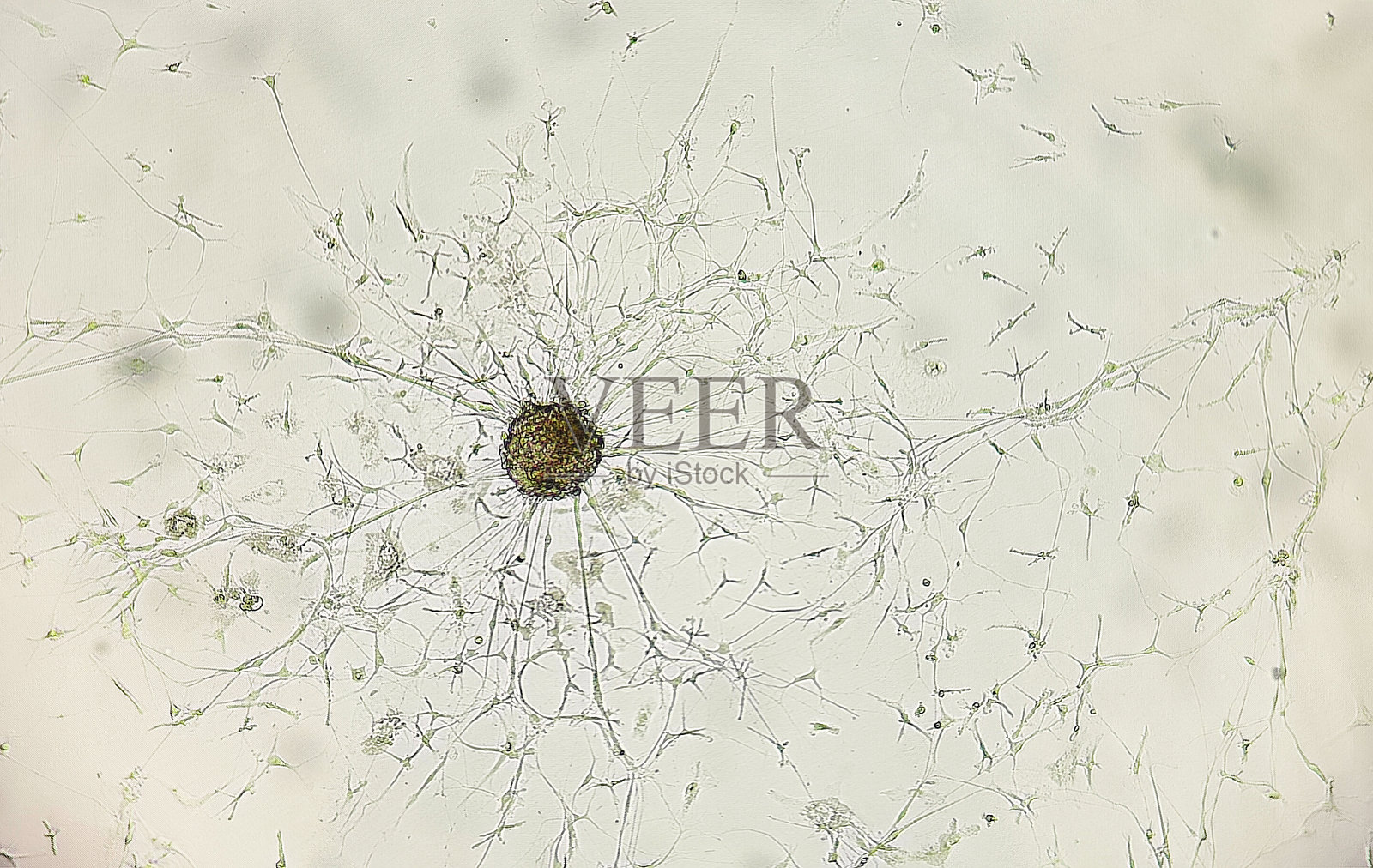 胶质母细胞瘤细胞培养。照片摄影图片
