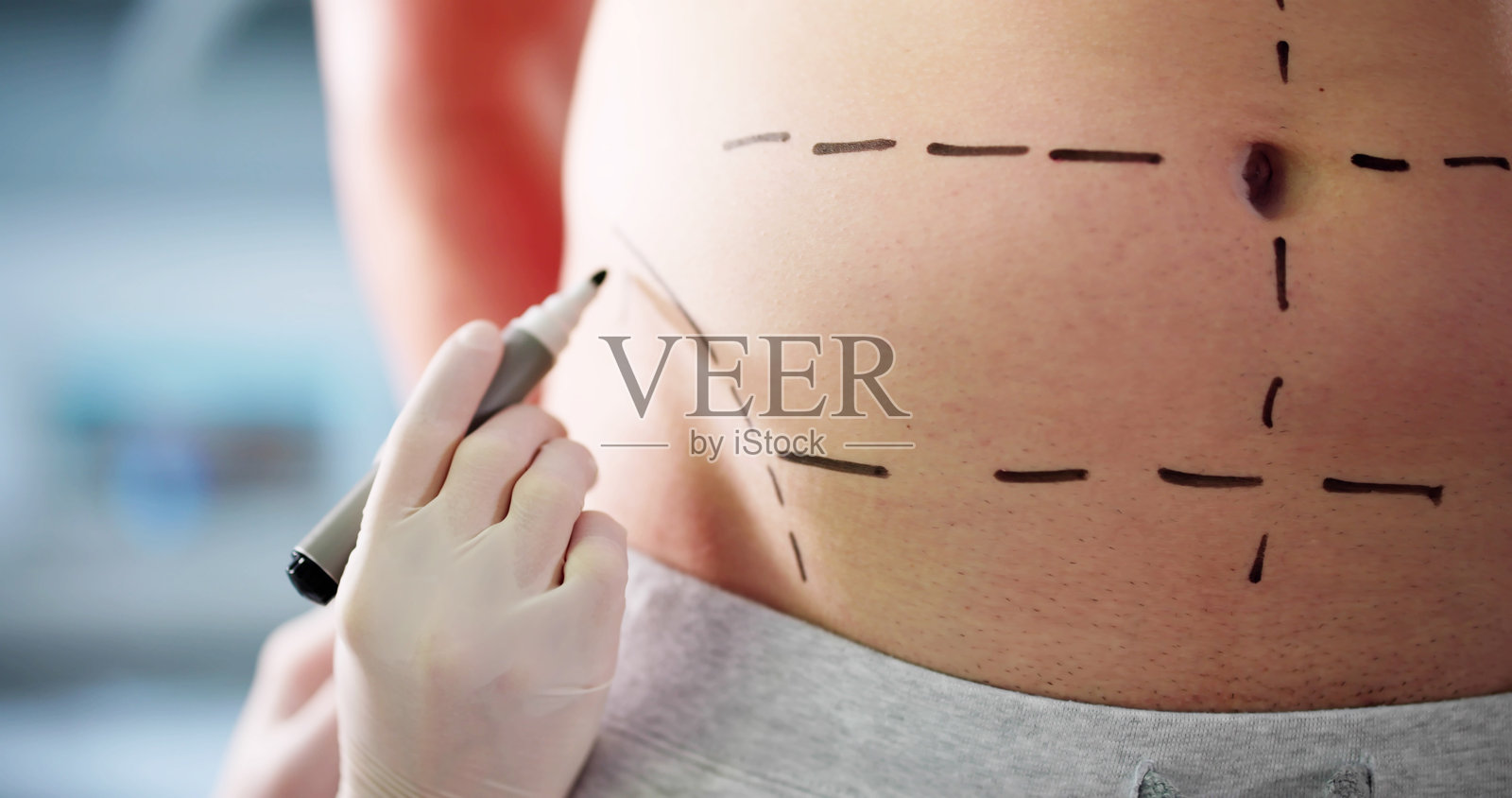 转变之旅：美容外科医生修复男子的腹部照片摄影图片