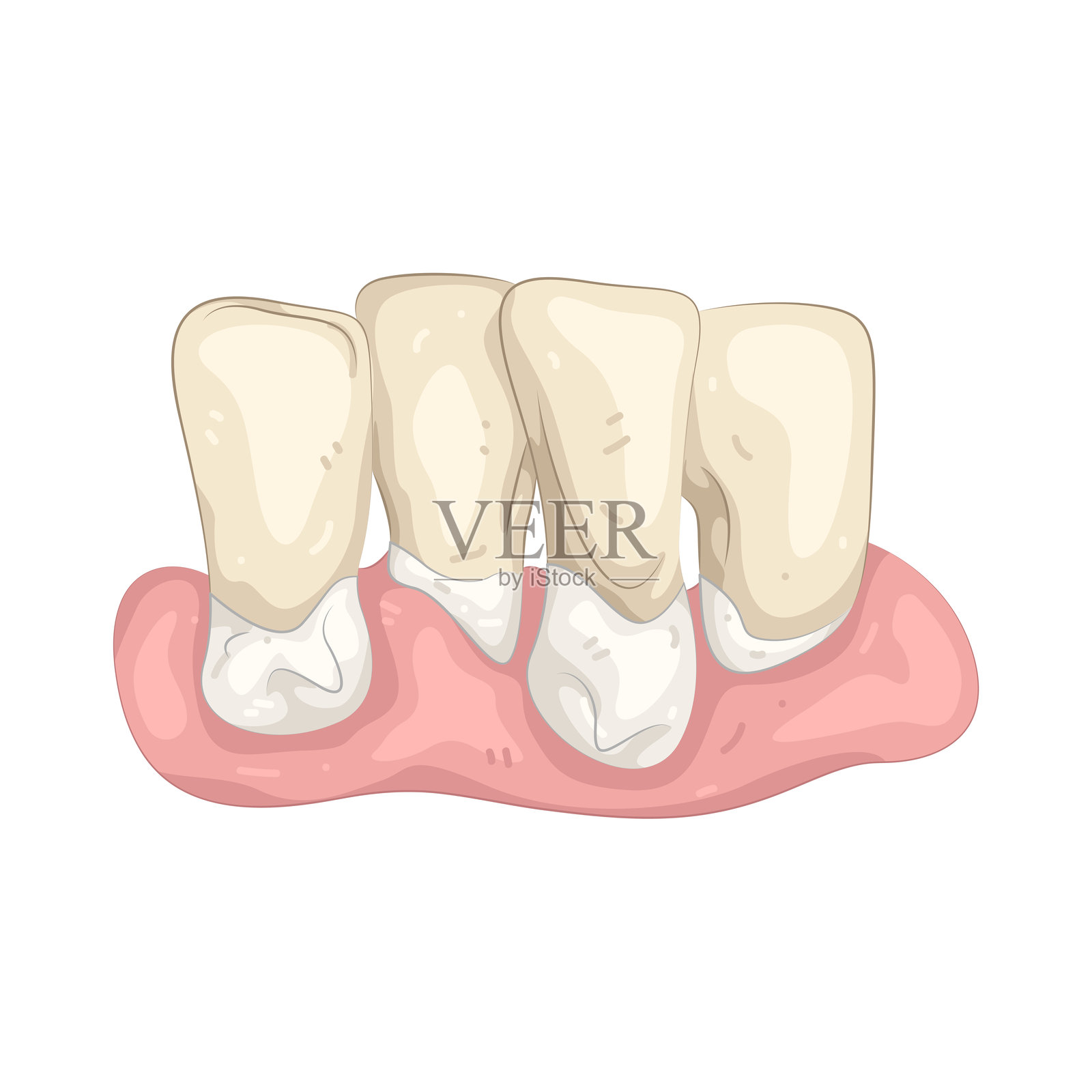 牙周炎插画图片素材