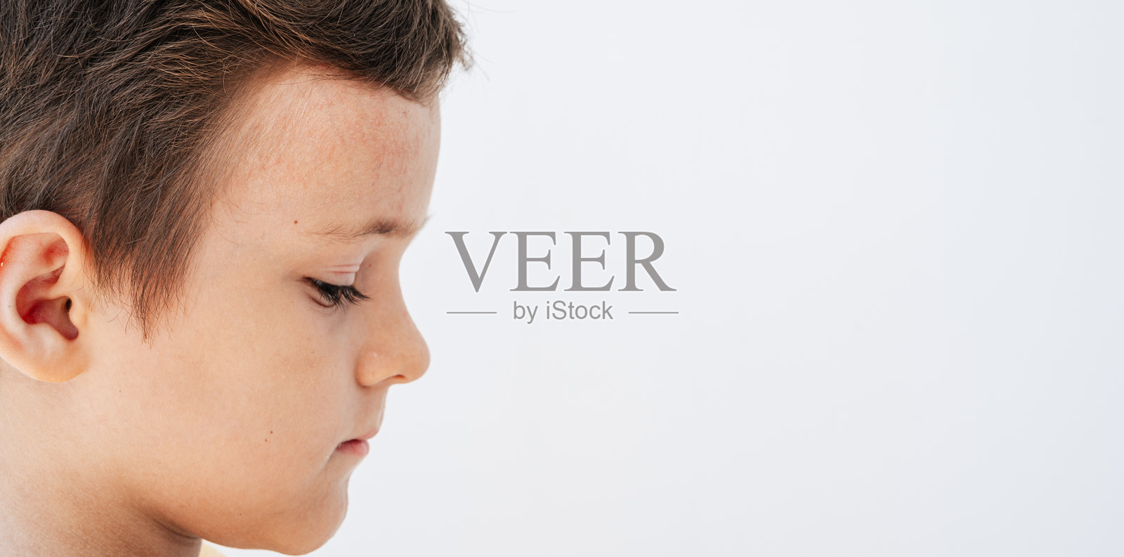 男孩脸上的斑点、水泡和皮疹，作为柯萨奇病毒的症状。照片摄影图片