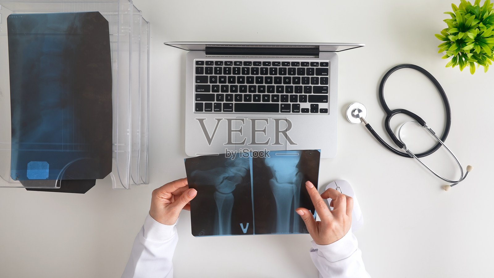 医生在现代医疗办公室桌子上查看X光图像照片摄影图片