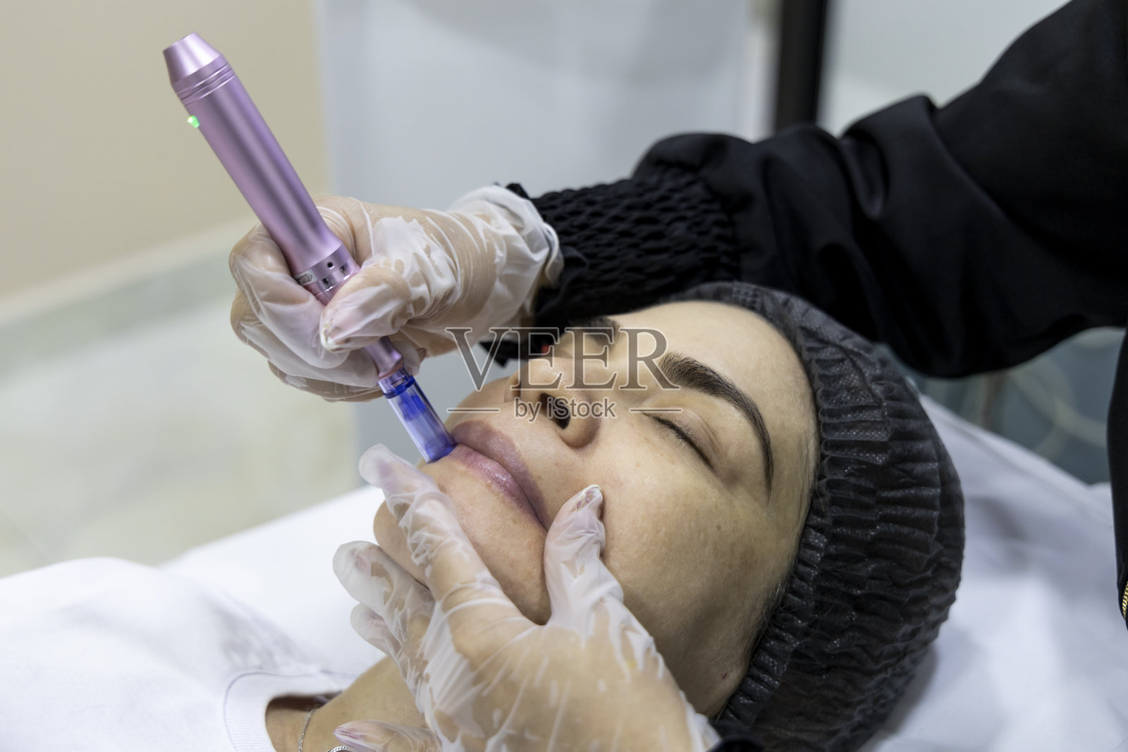 美容师在嘴唇上进行微针治疗，以刺激胶原蛋白并恢复肌肤活力照片摄影图片