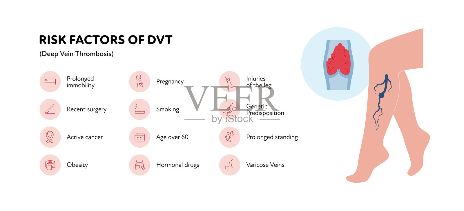 深静脉血栓形成医疗信息图。矢量轮廓图标集插图。DVT的风险因素。女性腿部血管内血栓的符号。用于医疗和教育的设计。插画图片素材