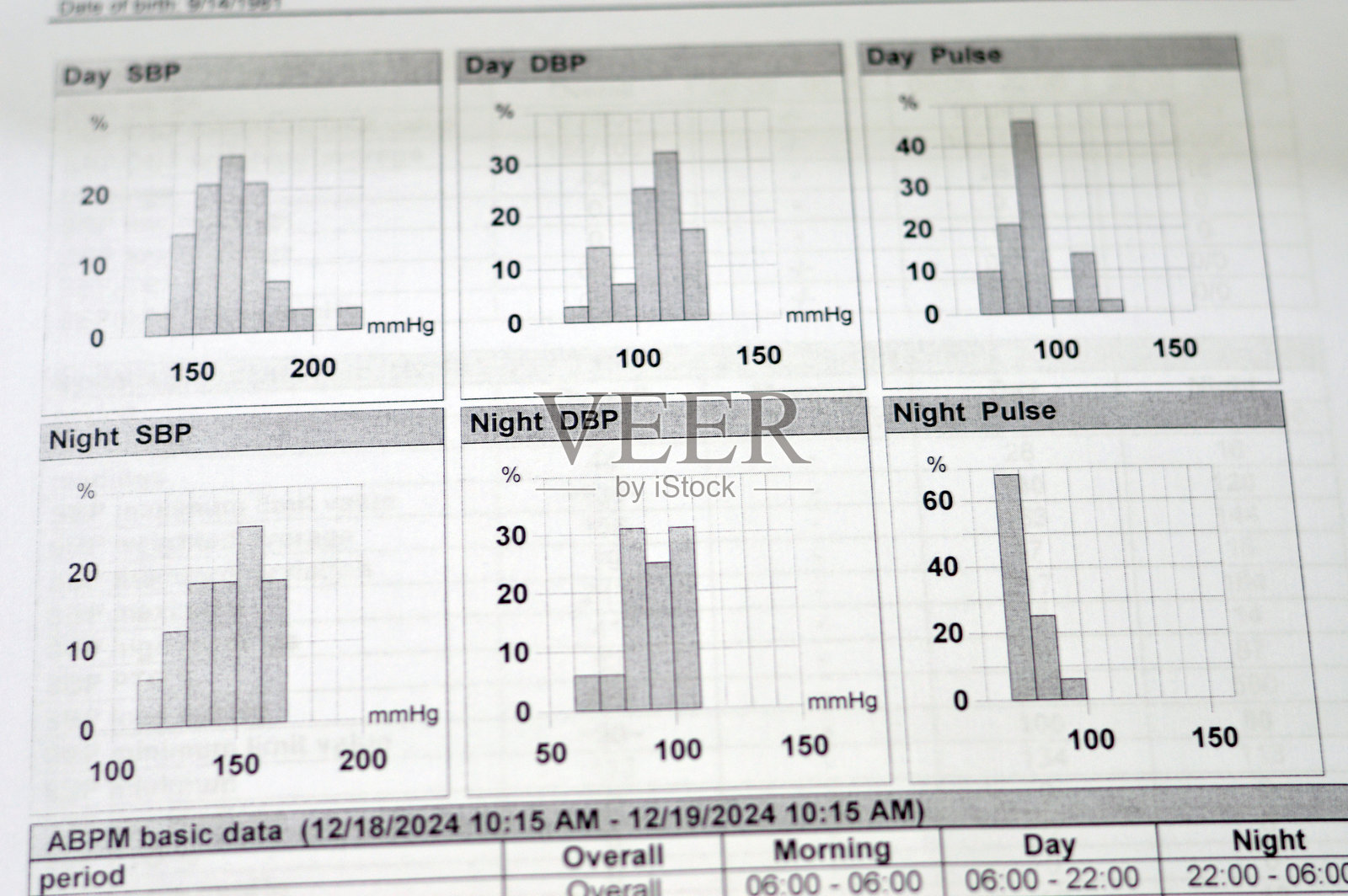 24小时动态血压监测的图表显示血压失控照片摄影图片
