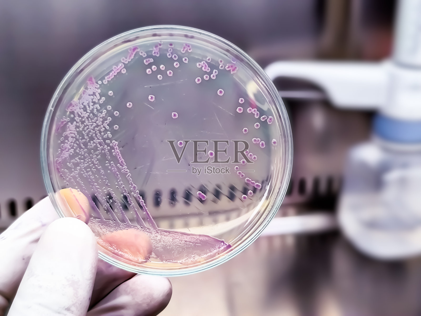 一个培养有致病性细菌大肠杆菌（E. coli）菌落的微生物培养平板。照片摄影图片