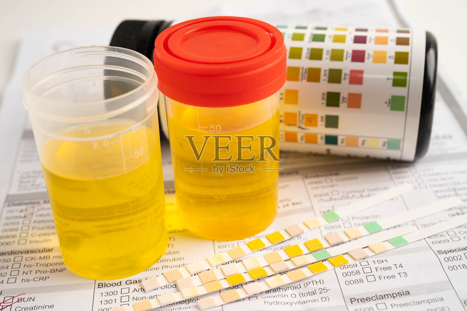 尿液分析，实验室中的尿液杯与试剂条pH纸测试及比较图表。照片摄影图片