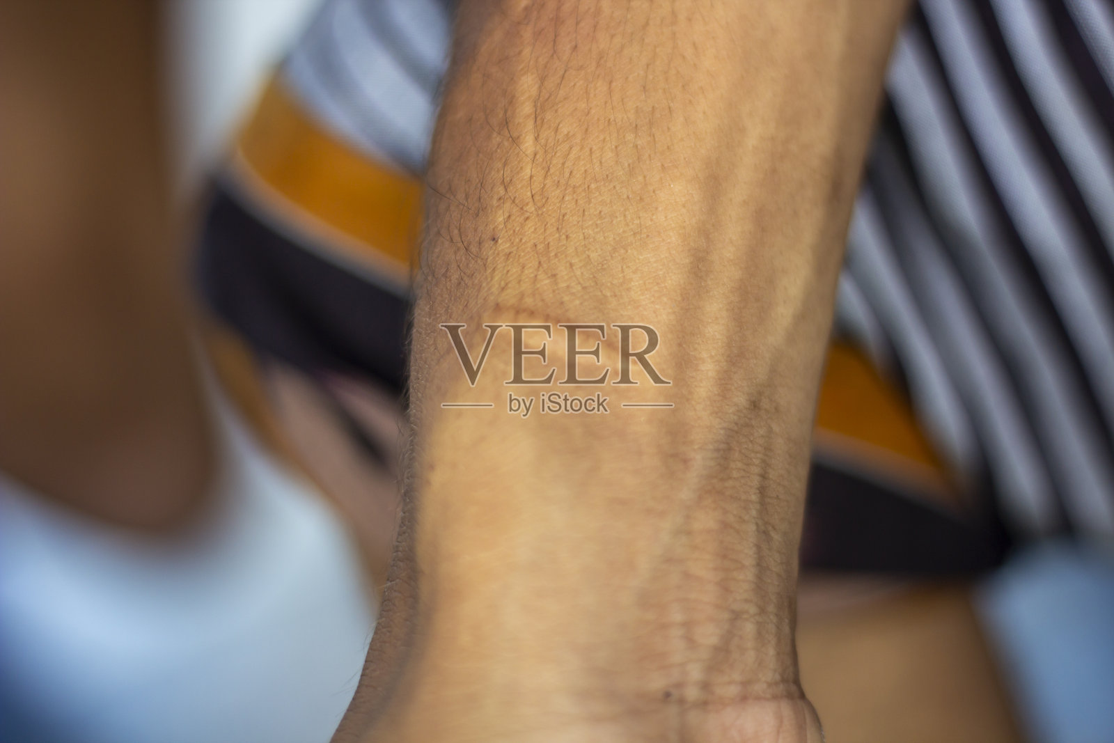 一个贫穷男孩腿上的小伤口照片摄影图片