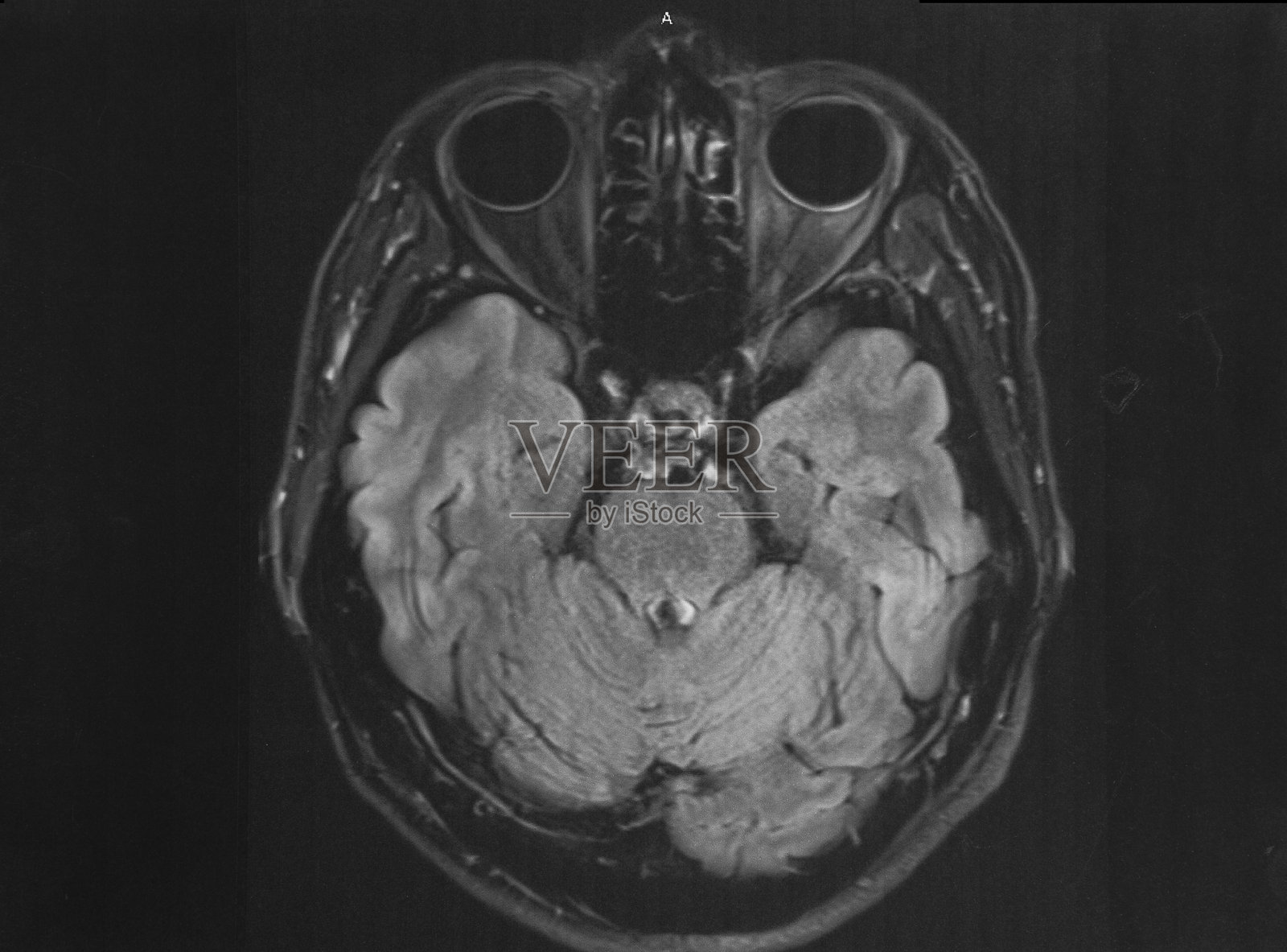 人脑MRI照片照片摄影图片
