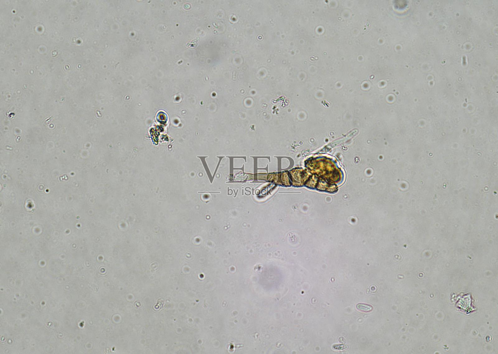 显微镜下的土壤微生物，包括变形虫、鞭毛虫、线虫、真菌和细菌照片摄影图片