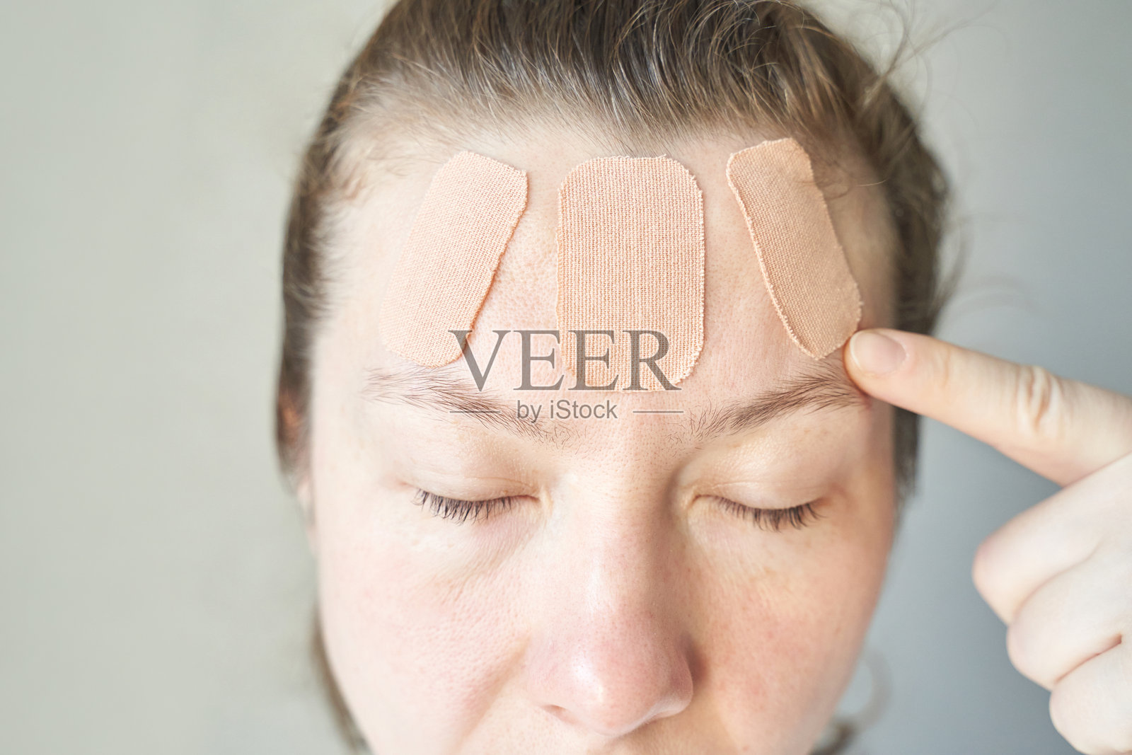 面部额头有皮肤斑块的女性白人成人，适用于皮肤护理或伤口处理照片摄影图片