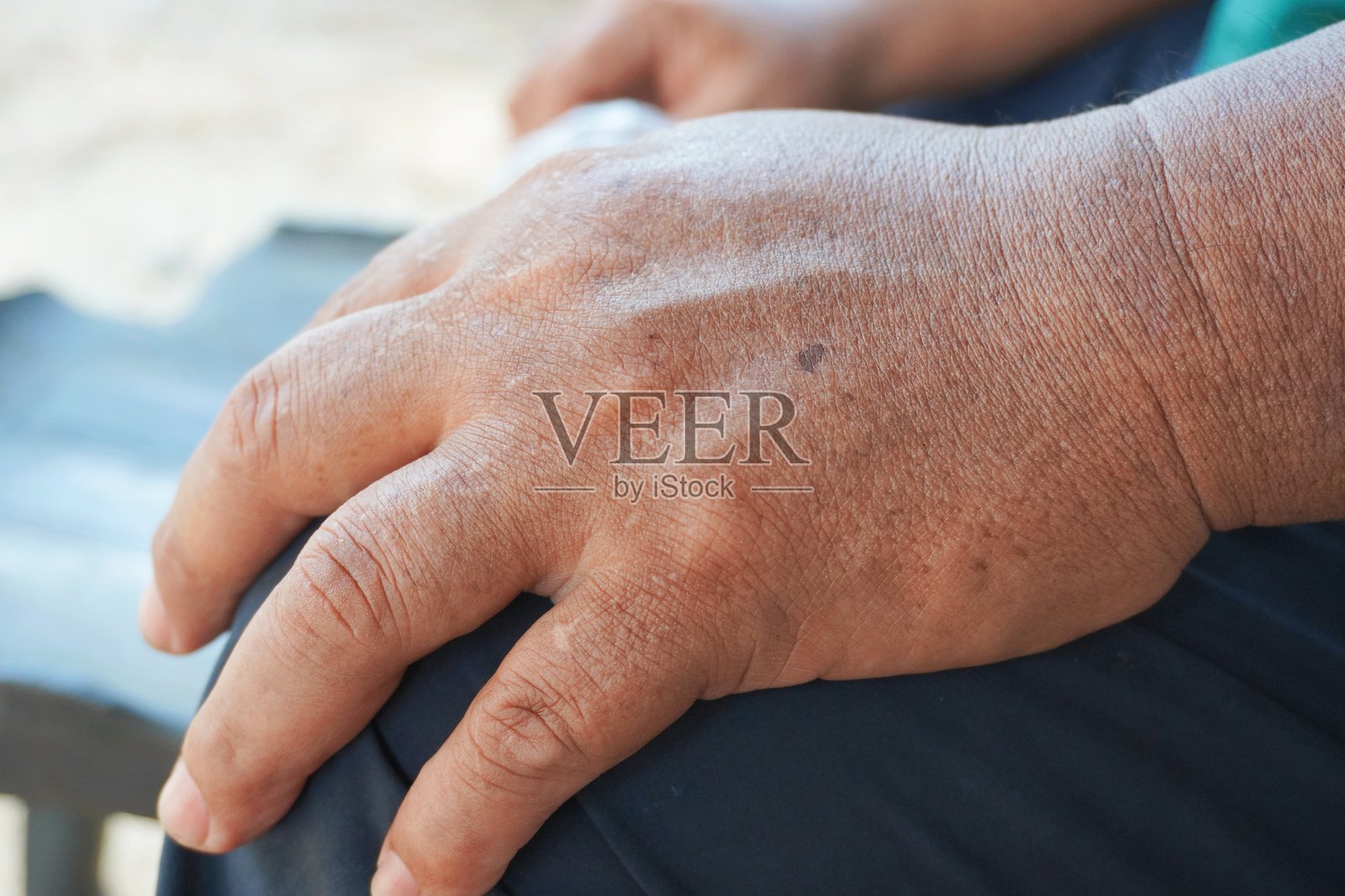 胖男人手的侧面。手背上皱纹明显，静脉突出，静脉更加明显，皮肤变化，皮肤问题。照片摄影图片