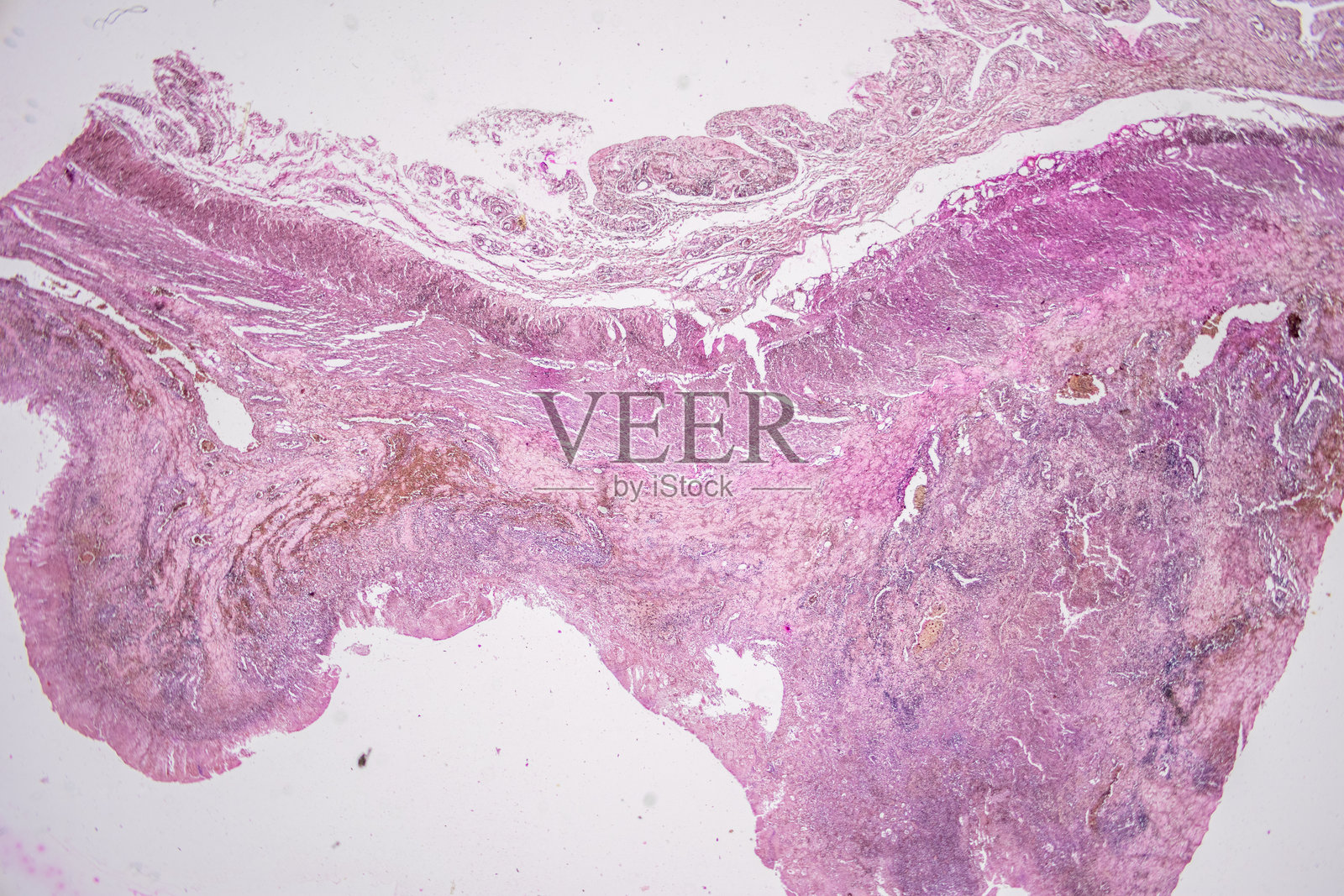 哺乳动物的病理学和组织学组织在显微镜下观察。照片摄影图片