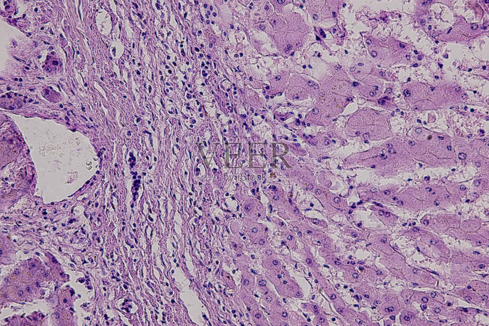 哺乳动物的病理学和组织学组织在显微镜下观察。照片摄影图片