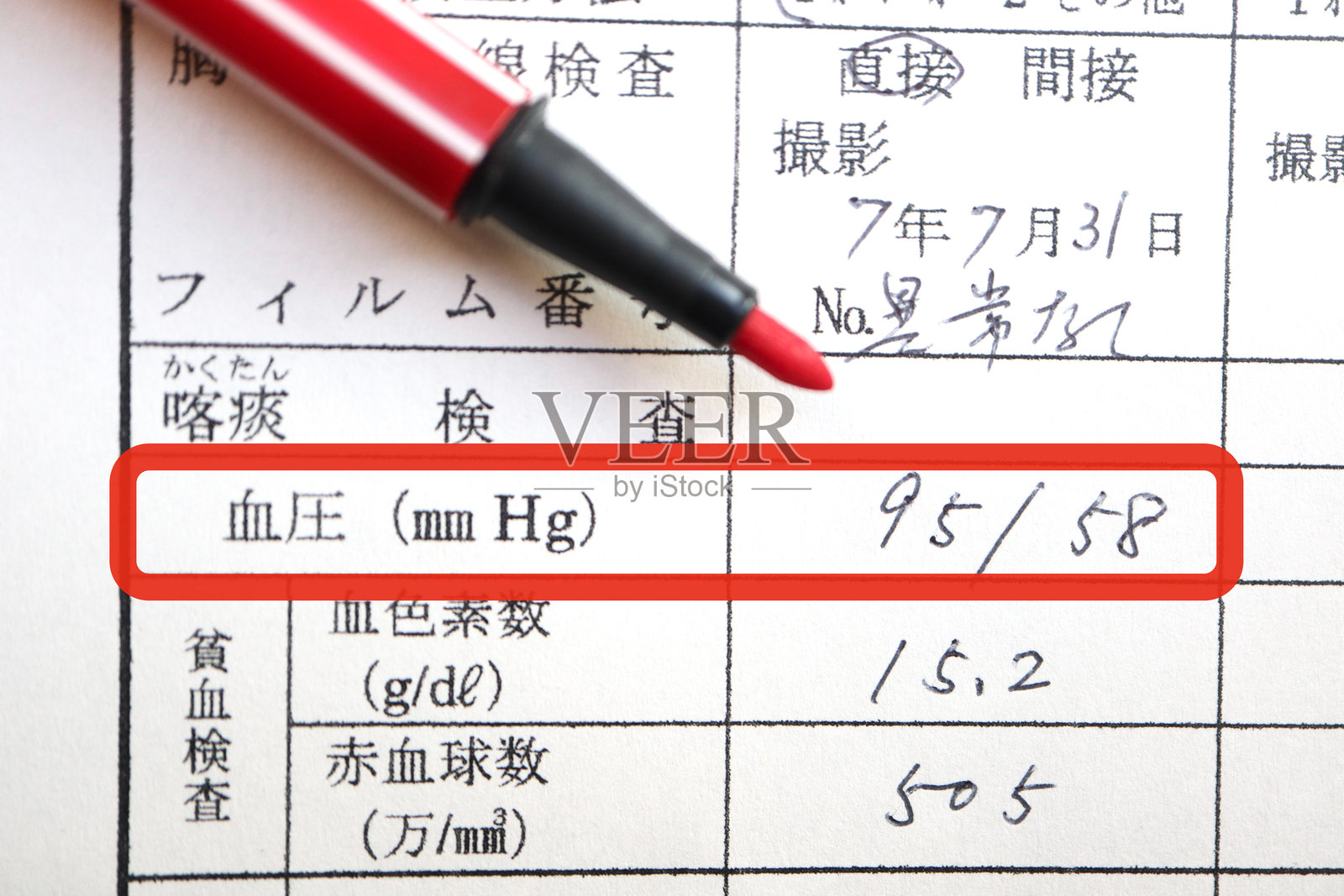 低血压。照片摄影图片