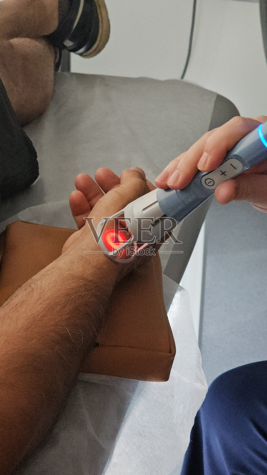 患者在医疗办公室接受前臂激光治疗。照片摄影图片