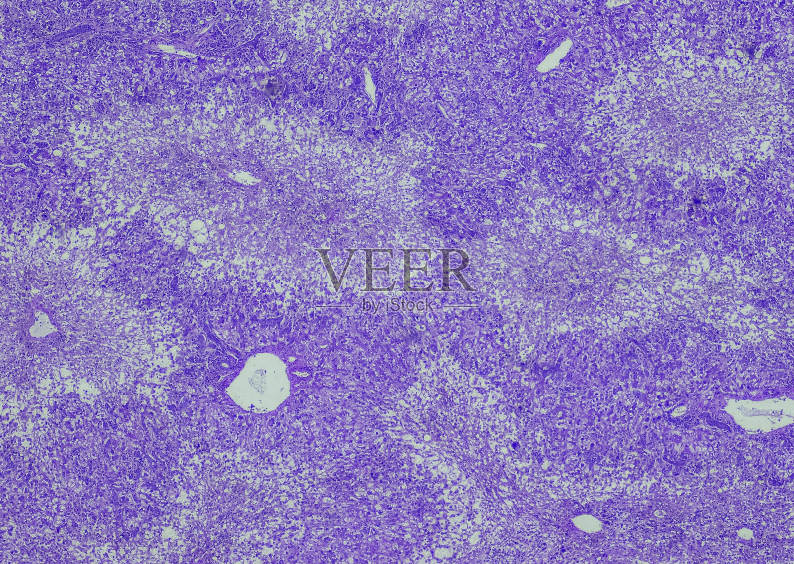 对乙酰氨基酚肝毒性照片摄影图片