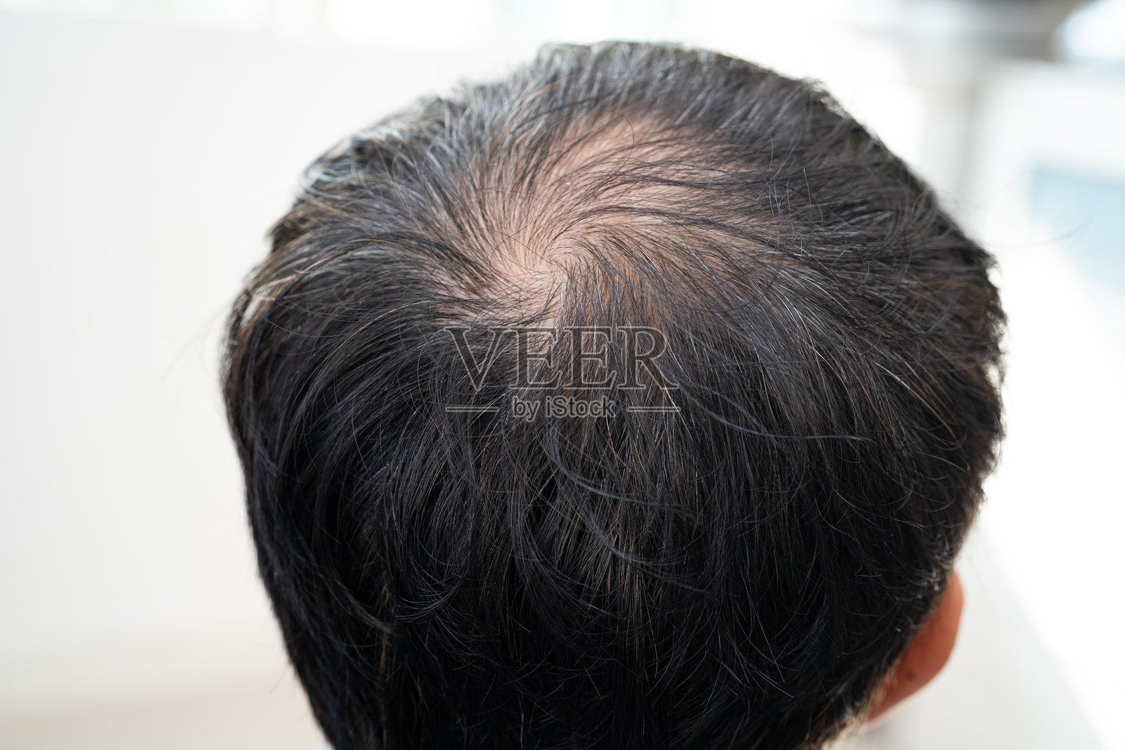 成熟的亚洲商务男士，头顶秃顶，开始出现脱发，聪明而积极，适合办公室环境。照片摄影图片