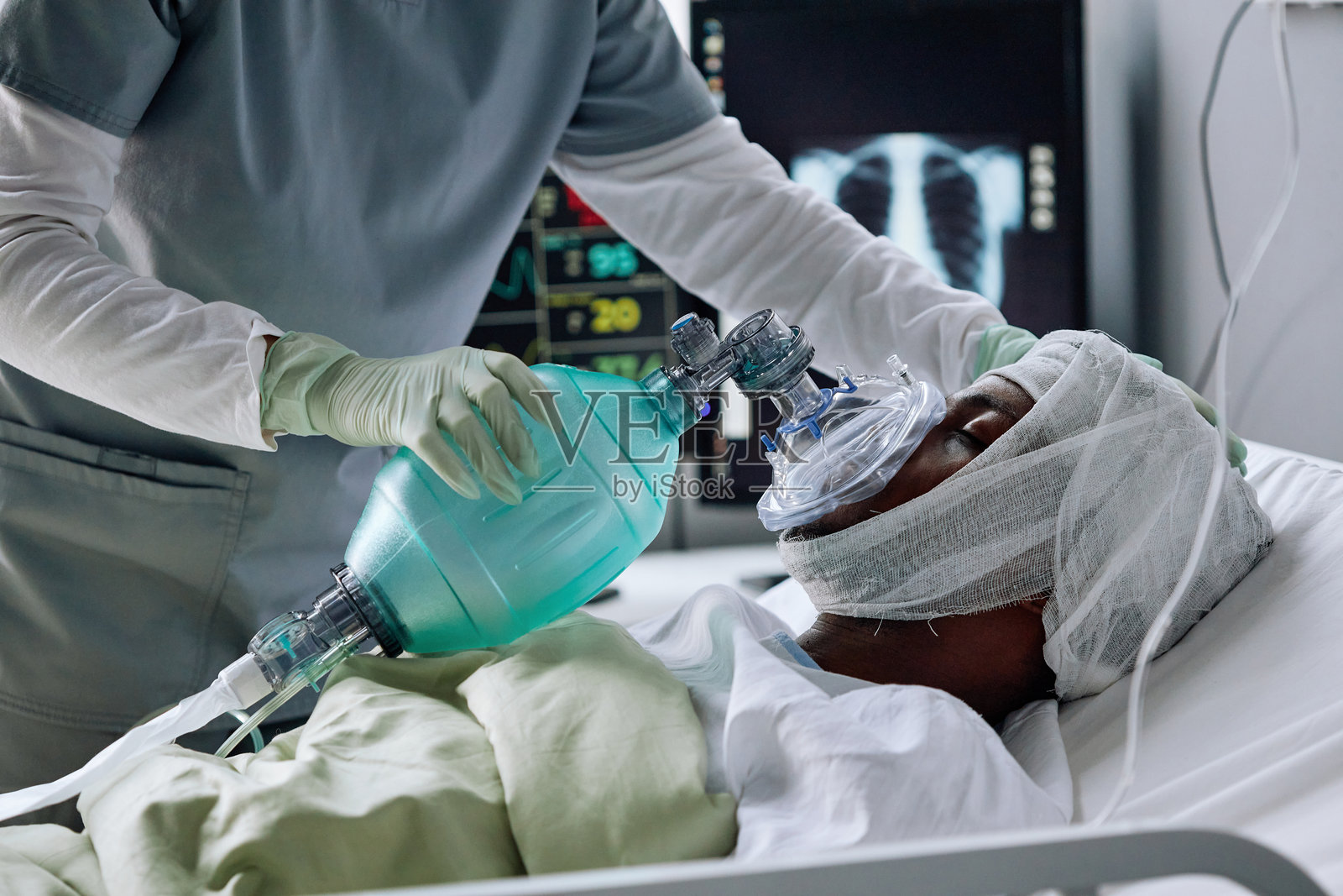 机械通气患者的护理照片摄影图片