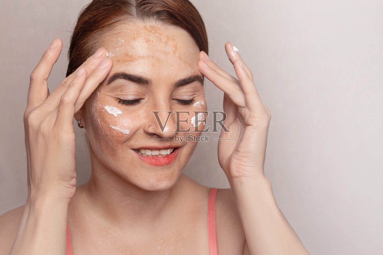 女性使用面霜来对抗色素沉着。含有防紫外线保护的面霜 SPF。面部有色素沉着、黄褐斑、雀斑和老年斑的照片。照片摄影图片