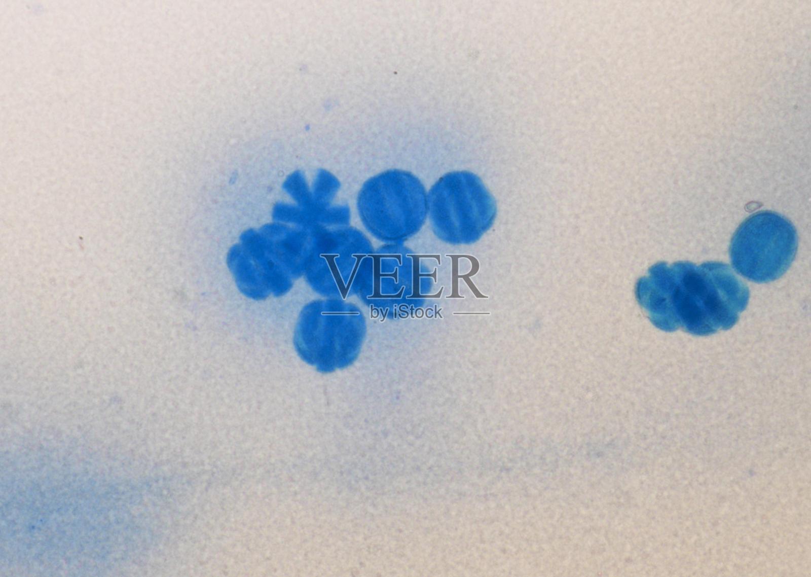 显微镜下的土壤微生物，包括变形虫、鞭毛虫、线虫、真菌和细菌照片摄影图片