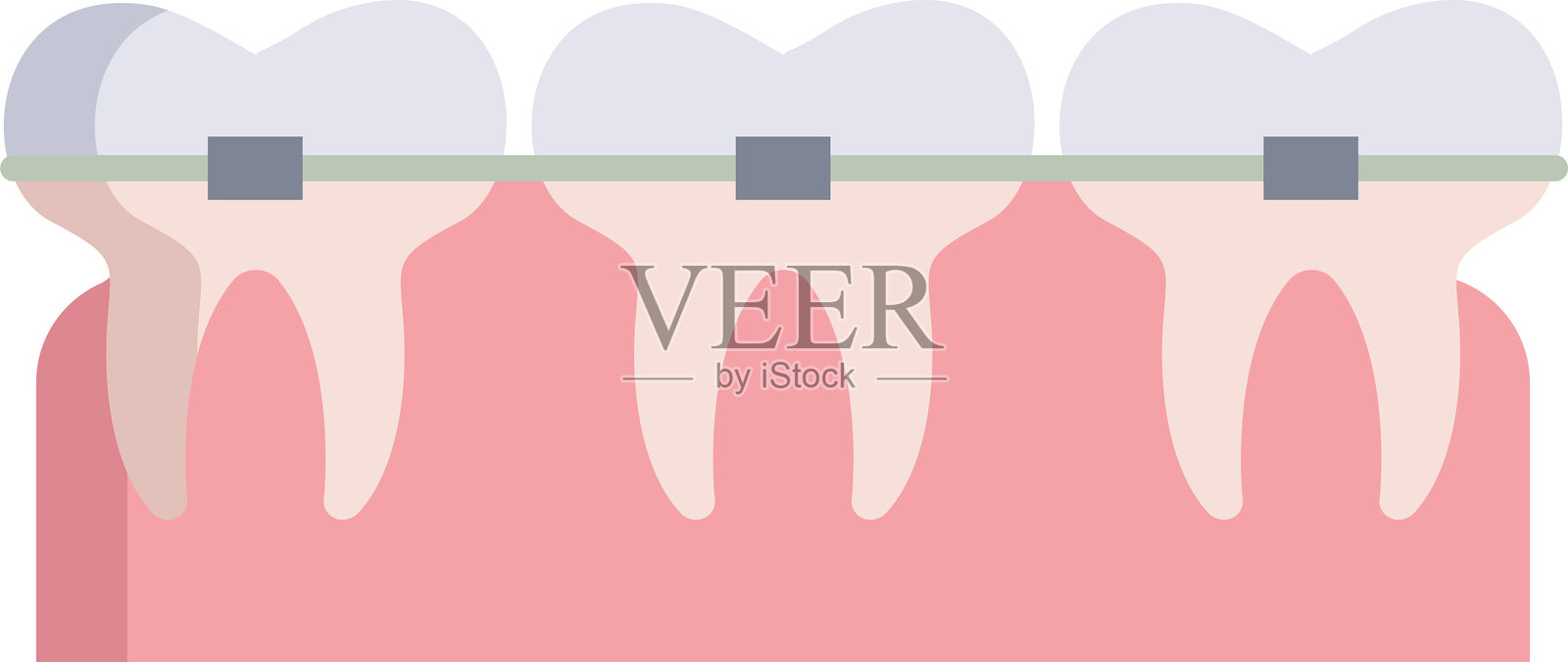 牙套扁平图标设计插画图片素材