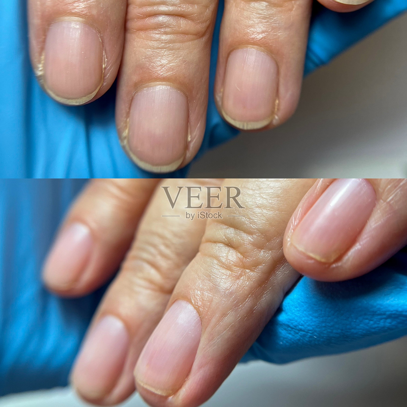 自然指甲的卫生修甲前后特写，干净的指缘和柔和的光泽，配有蓝色手套的支持。照片摄影图片