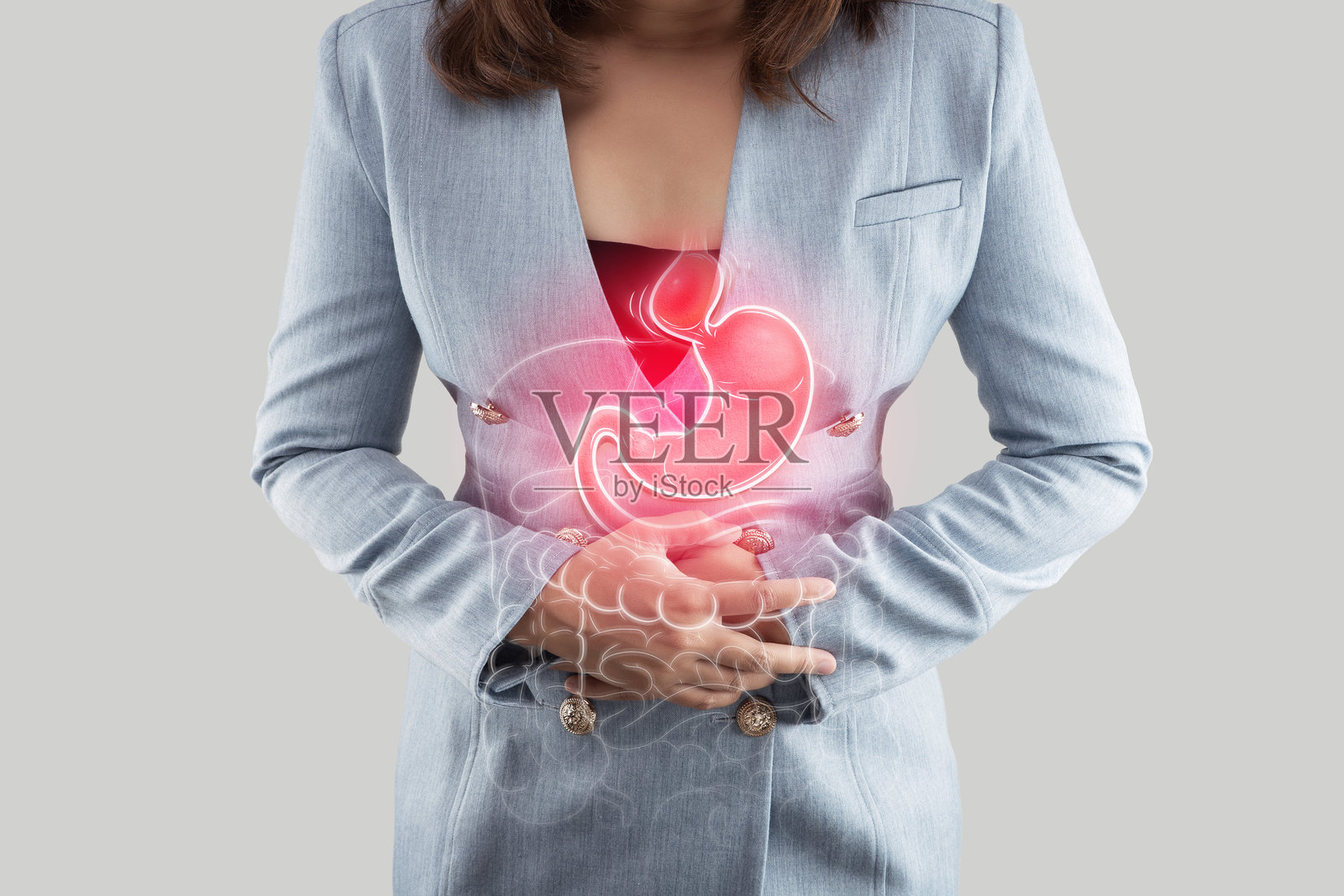 食管裂孔疝导致上腹部隆起，如医学插图所示。照片摄影图片