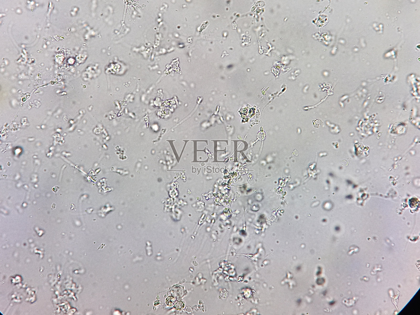 畸形精子症或运动精子症，显微镜检查下的异常精液分析。照片摄影图片