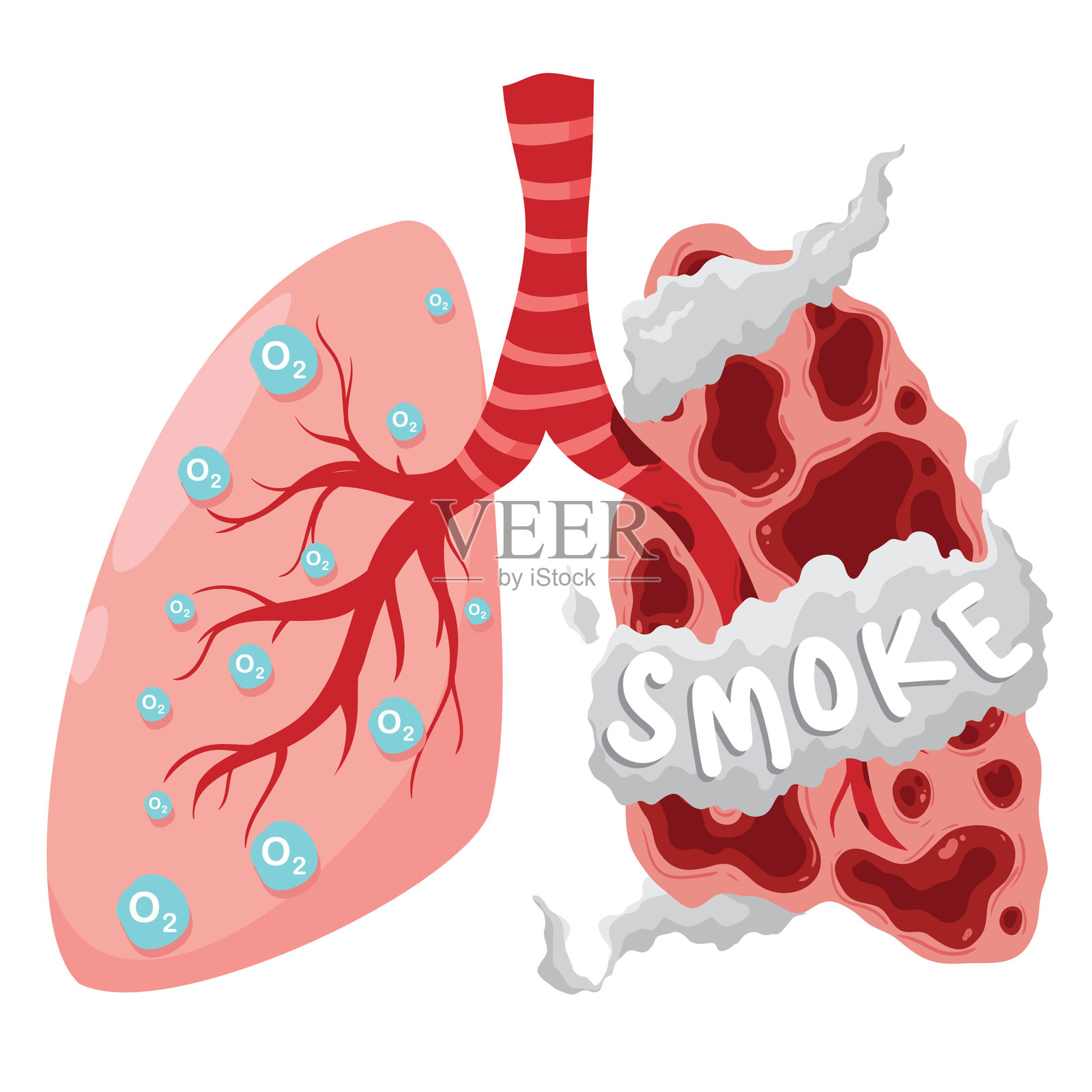 健康的肺与吸烟者的肺：烟雾的影响插画图片素材