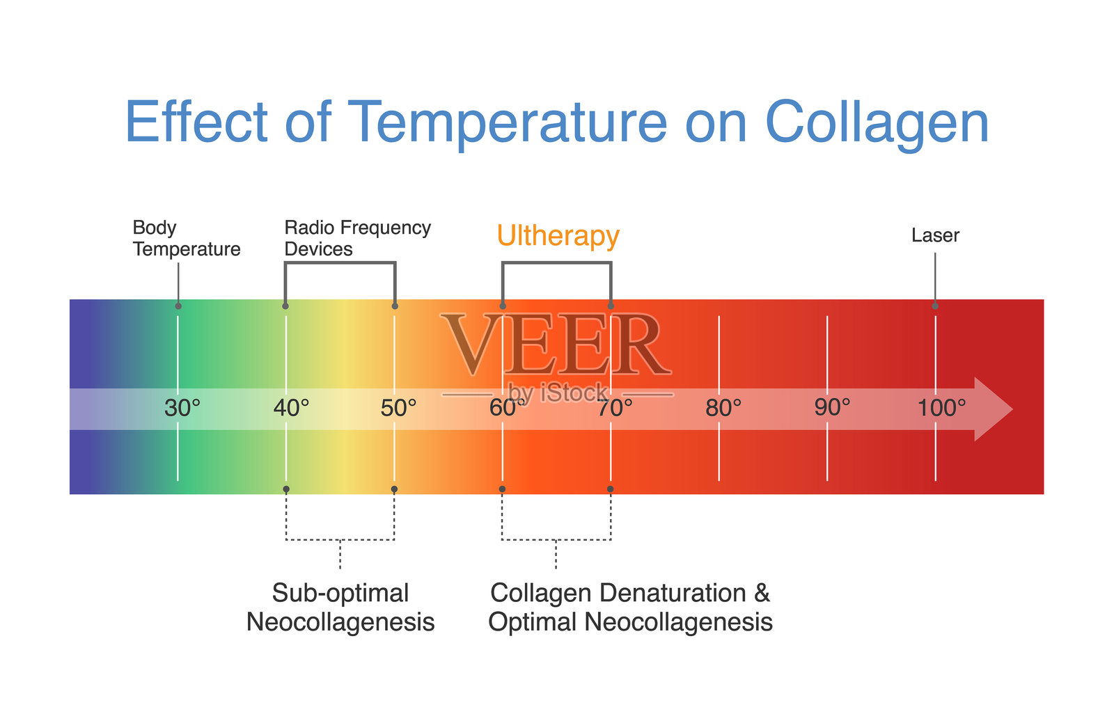 温度对胶原蛋白的影响与超声刀和射频设备。关于面部皮肤提升治疗的图示，展示了使用能量射击设备刺激皮肤层中的胶原蛋白和弹性蛋白。插画图片素材