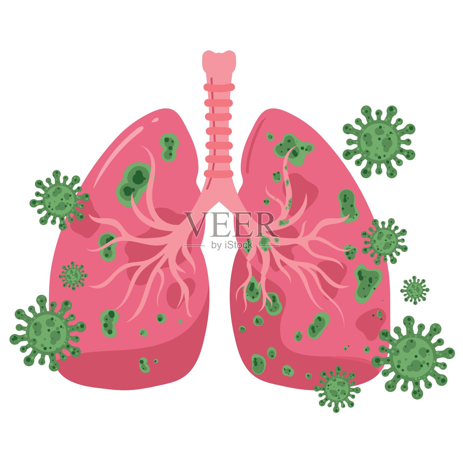 感染病毒的肺部，医学插图插画图片素材