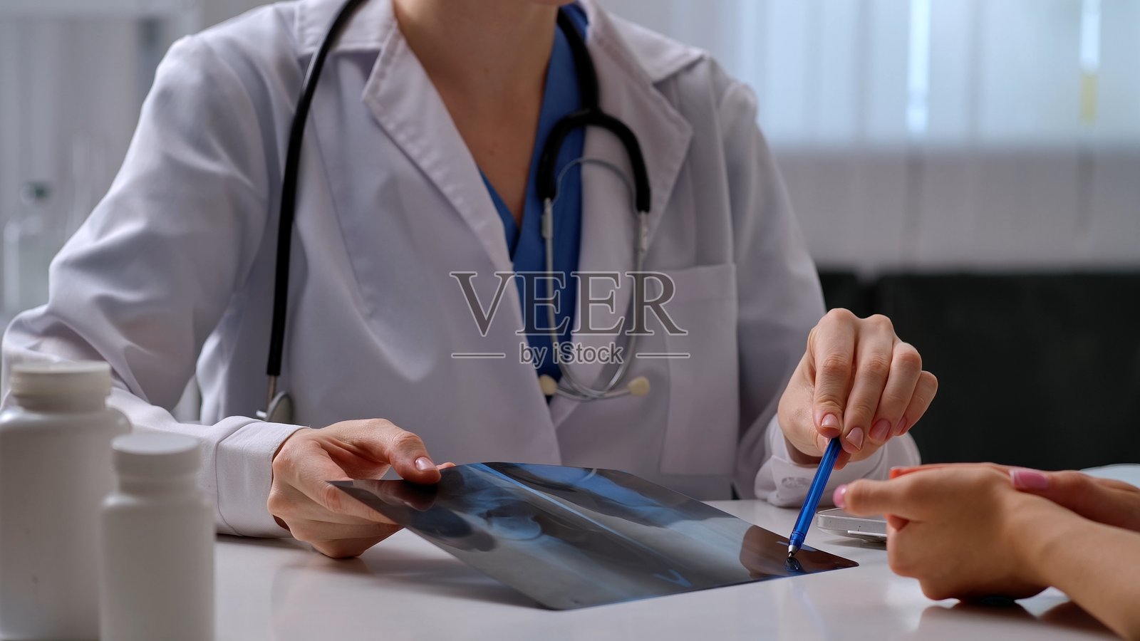 医生在医学咨询中分析患者的X光片照片摄影图片