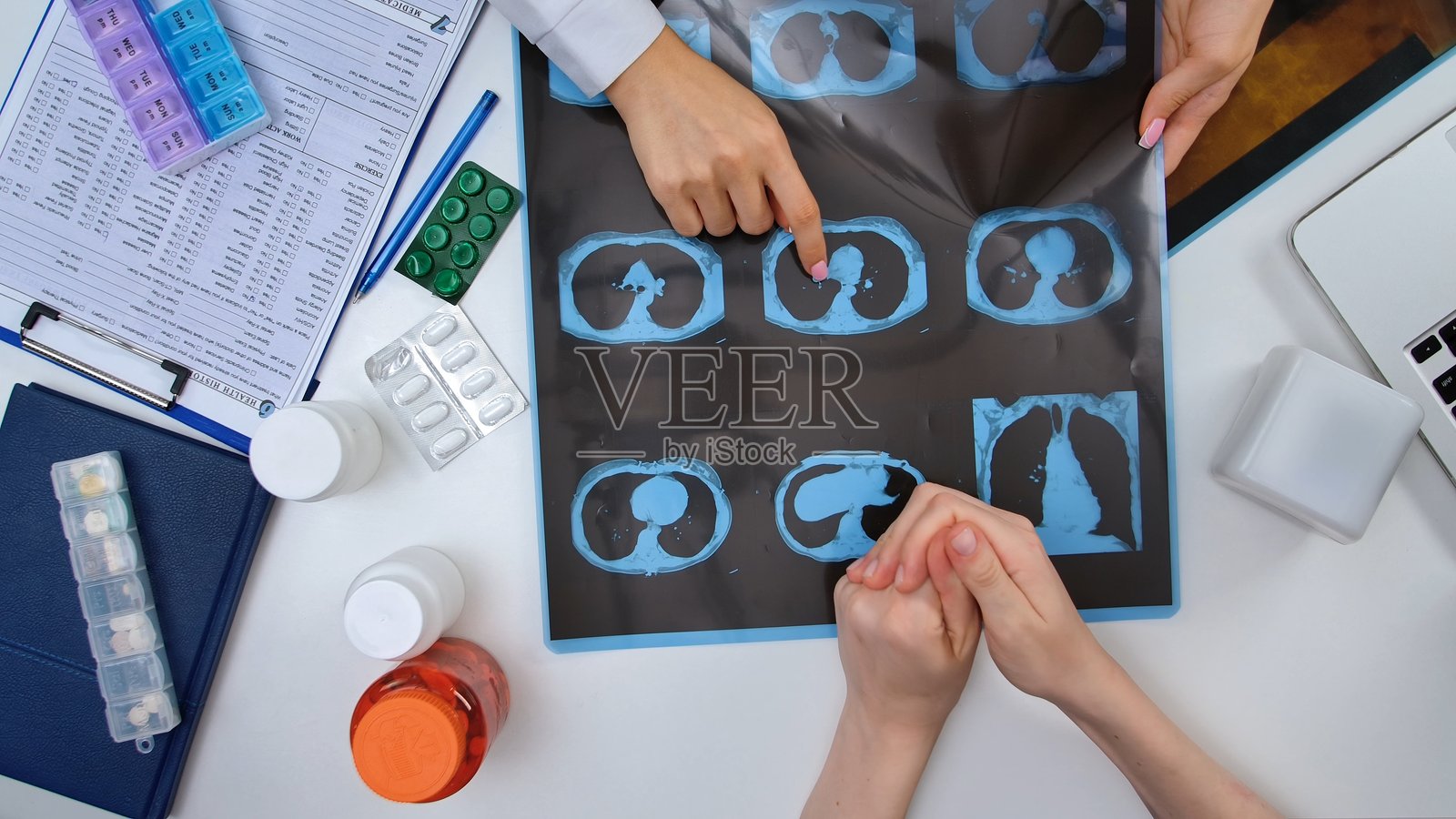 医生在医疗桌前分析X光片结果照片摄影图片