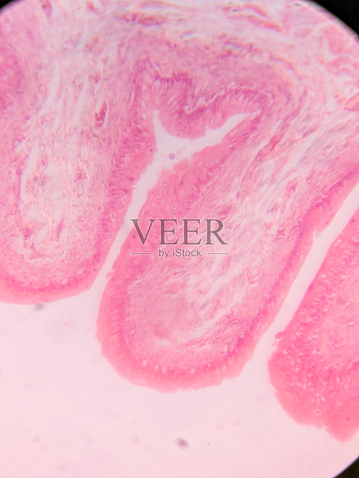 显微镜下正常膀胱壁的组织学照片摄影图片