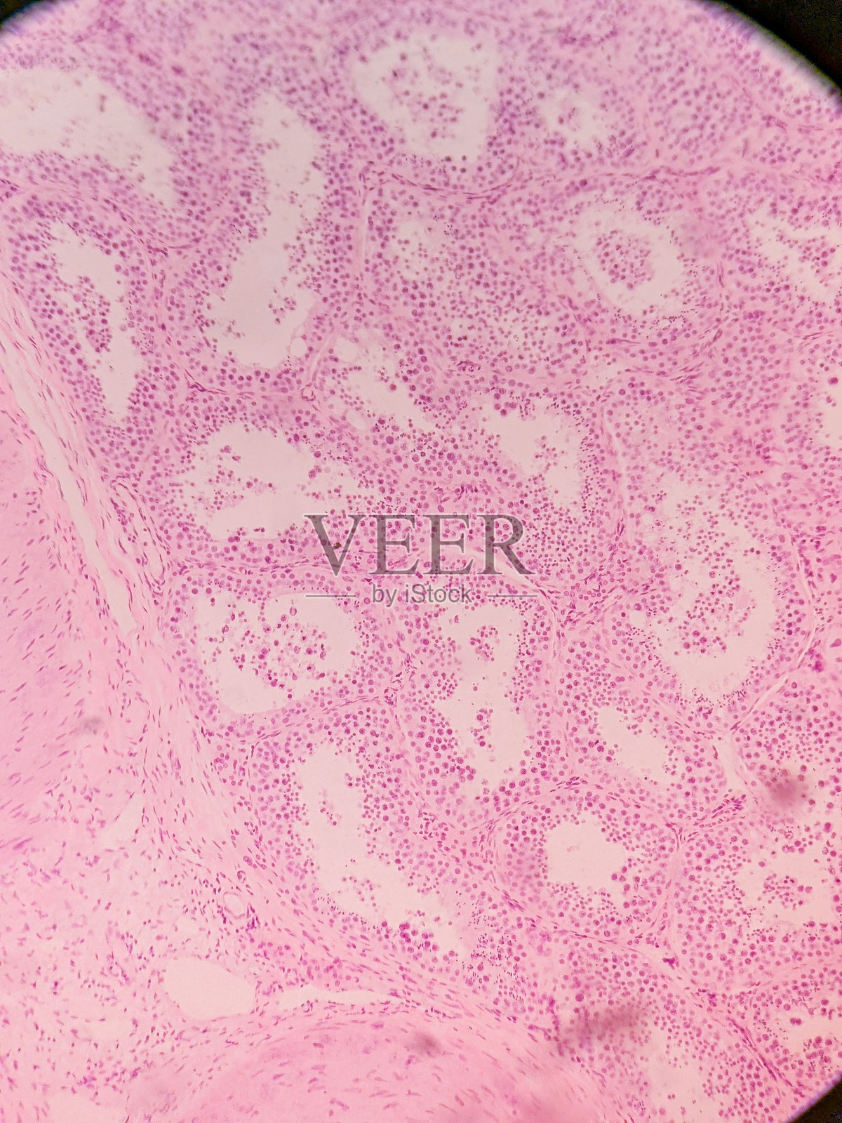 人类睾丸：精细小管照片摄影图片