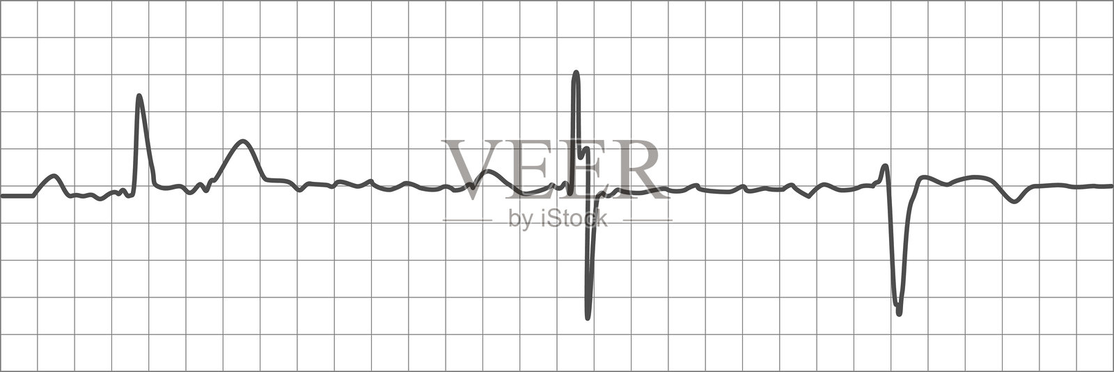 高质量的心电图波形在网格上清晰展示心跳模式，适合用于医疗、健康和科学相关项目，适合教育或专业用途。插画图片素材