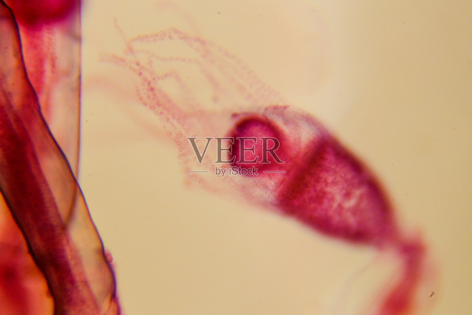 雌性尤氏螅属群体，带有发育中的性腺孢子照片摄影图片